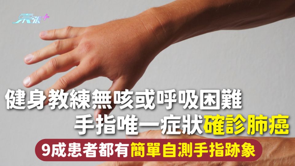 肺癌 | 健身教練無咳或呼吸困難 手指唯一症狀確診肺癌 9成患者都有 簡單自測手指跡象
