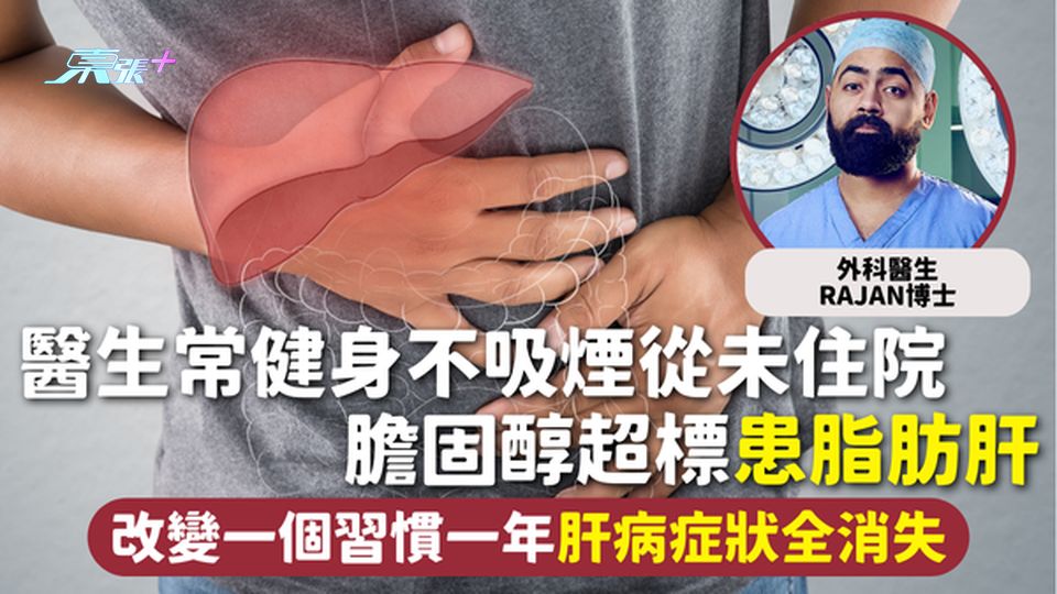 脂肪肝 | 醫生常健身不吸煙從未住院 膽固醇超標患脂肪肝 改變一個習慣一年肝病症狀全消失