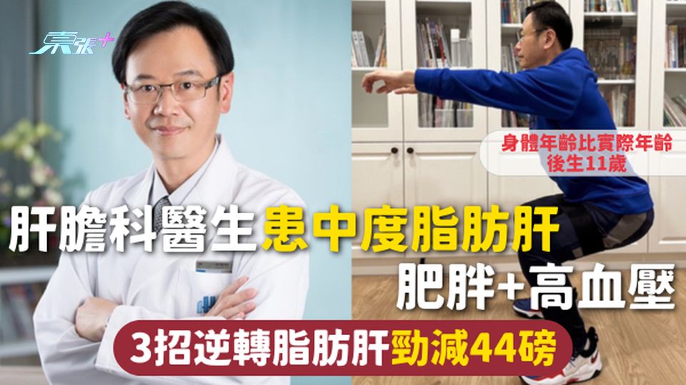 脂肪肝 | 肝膽科醫生患中度脂肪肝 肥胖+高血壓 3招逆轉脂肪肝勁減44磅