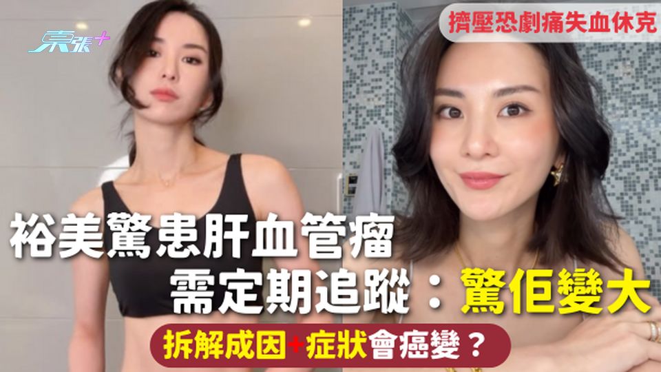 肝血管瘤 | 裕美驚患肝血管瘤 需定期追蹤：驚佢變大 拆解成因+症狀會癌變？擠壓恐劇痛失血休克