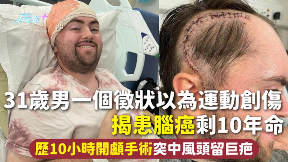 腦癌 | 31歲男一個徵狀以為運動創傷 揭患腦癌剩10年命 歷10小時開顱手術突中風頭留巨疤