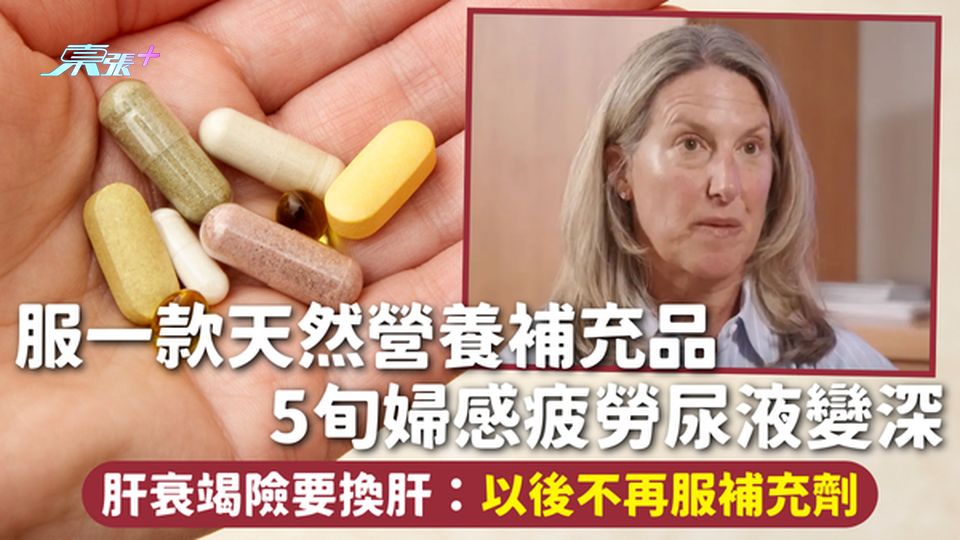 補充劑危機 | 服一款天然營養補充品 5旬婦感疲勞尿液變深 肝衰竭險要換肝：以後不再服補充劑