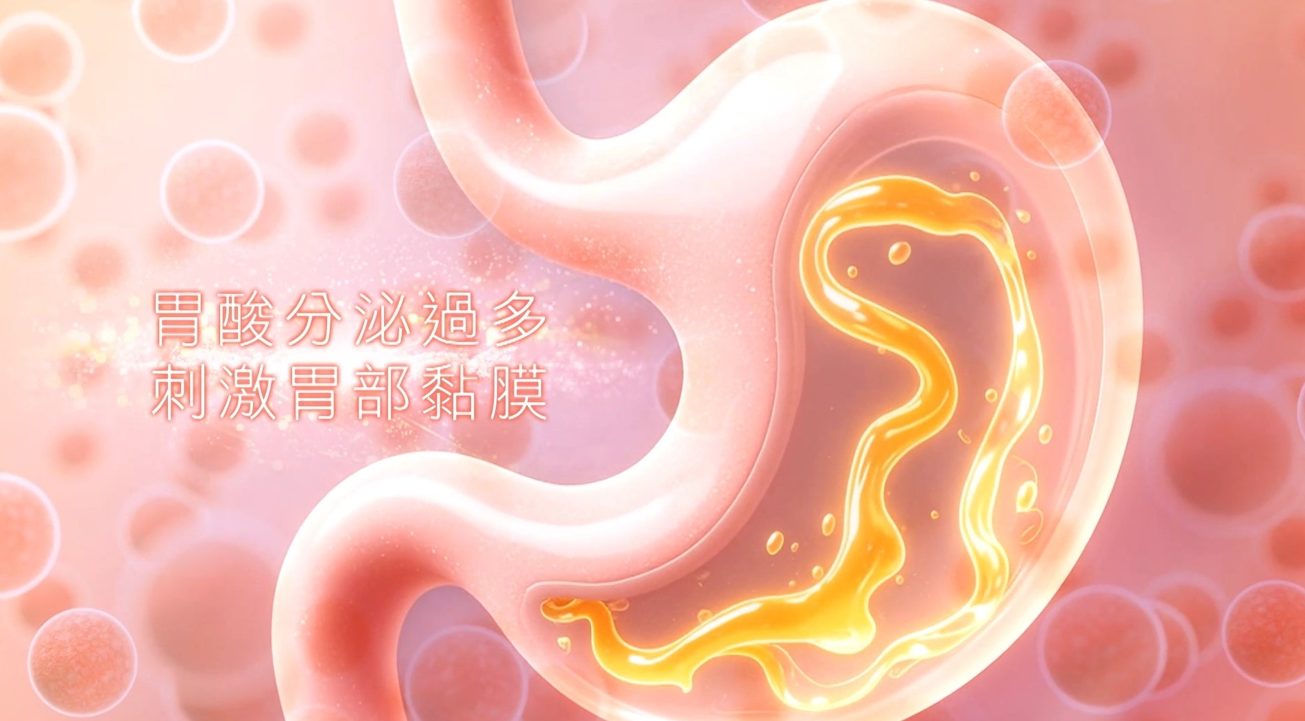 家庭醫生張永德表示，長時間飲食不定時、壓力大，都會刺激胃部肌肉收縮緊張。