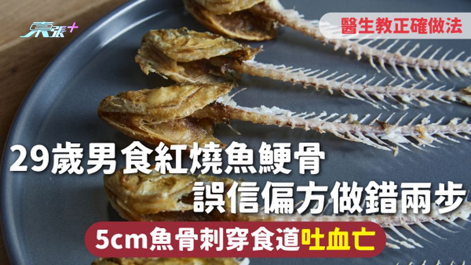 鯁魚骨 | 29歲男食紅燒魚鯁骨 誤信偏方做錯兩步 5cm魚骨刺穿食道吐血亡 醫生教正確做法