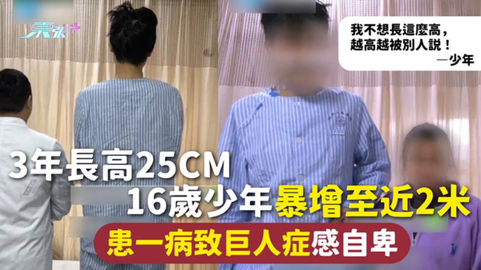 巨人症 | 3年長高25cm 16歲少年暴增至近2米 患一病致巨人症感自卑