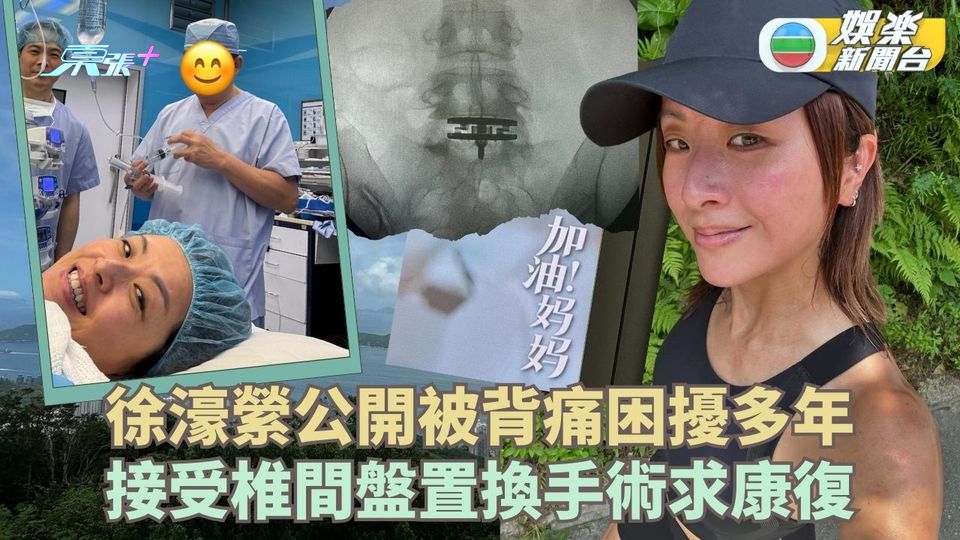 徐濠縈公開被背痛困擾多年 接受椎間盤置換手術求康復
