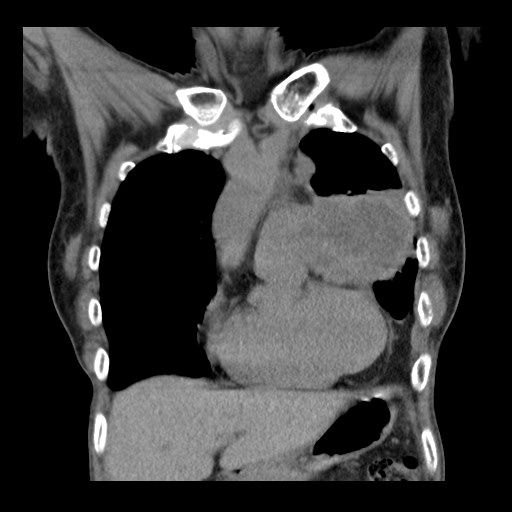 May be an image of xray