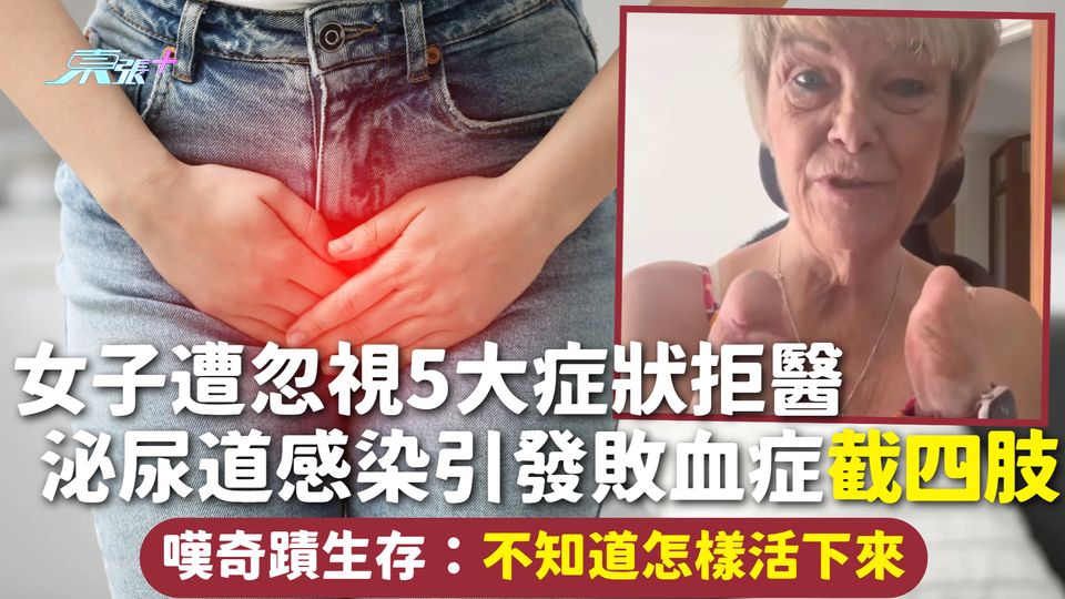 敗血症 | 女子遭忽視5大症狀拒醫 泌尿道感染引發敗血症截四肢 嘆奇蹟生存：不知道怎樣活下來