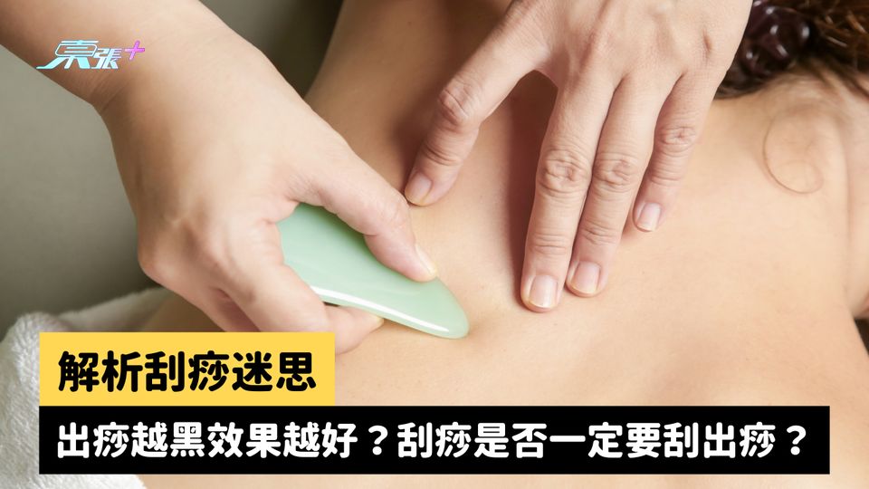 解析刮痧迷思：出痧越黑效果越好？刮痧是否一定要刮出痧？ #至識健康