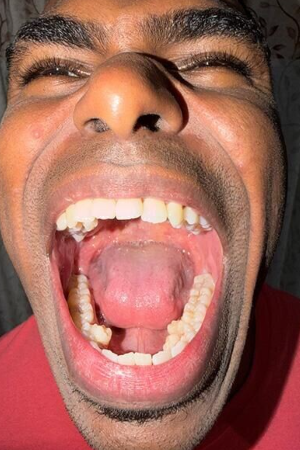 大馬男子生「42隻牙」刷新世界紀錄　X光照曝光無P圖震驚大眾