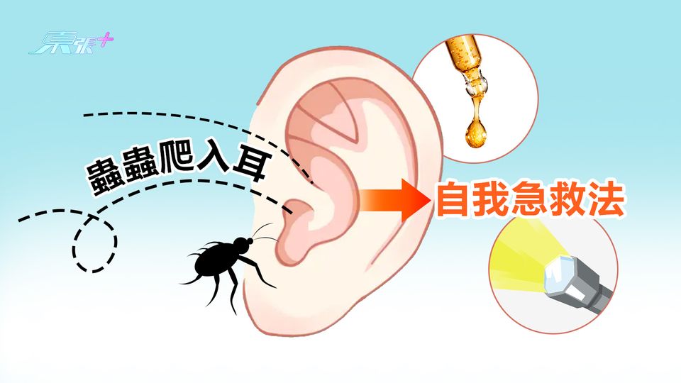 蟲蟲爬入耳 自我急救法
