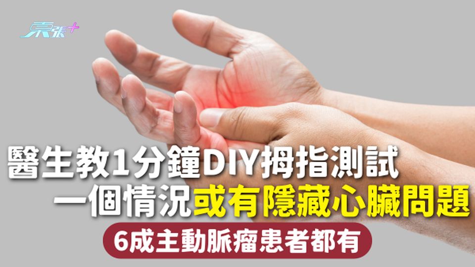 健康測試 | 醫生教1分鐘DIY拇指測試 一個情況或有隱藏心臟問題 6成主動脈瘤患者都有