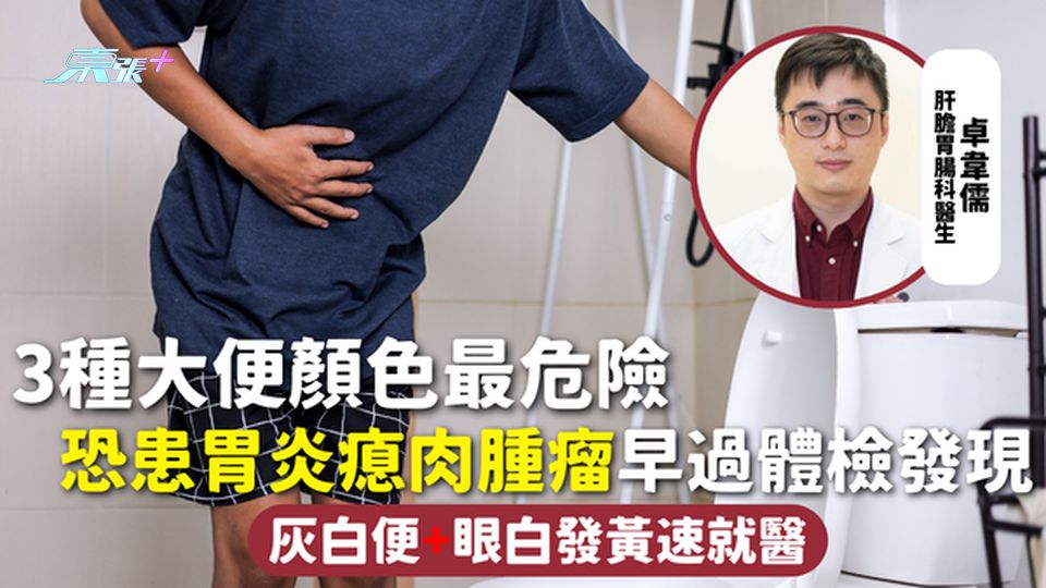大便顏色 | 3種大便顏色最危險 恐患胃炎瘜肉腫瘤早過體檢發現 灰白便+眼白發黃速就醫