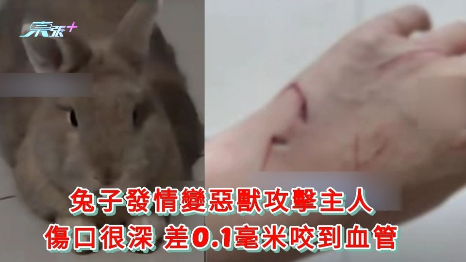 有片丨兔子發情變惡獸攻擊主人 傷口很深 差0.1毫米咬到血管
