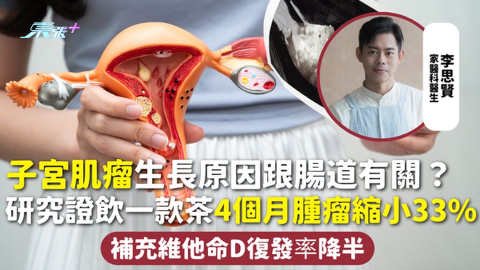 子宮肌瘤｜生長原因跟腸道有關？研究證飲一款茶 4個月腫瘤縮小33% 補充維他命D復發率降半