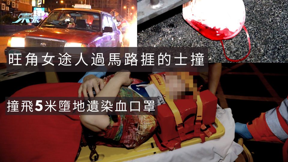 旺角女途人過馬路捱的士撞　撞飛5米墮地遺染血口罩
