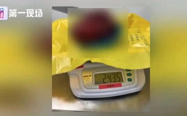 ▲▼ 17歲女孩買衣服時經店員一句提醒，發現體內藏著巨大腫瘤   。（圖／翻攝 第一現場）