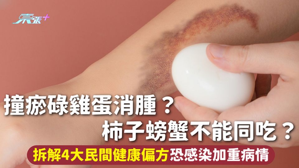 民間偏方 | 撞瘀碌雞蛋消腫？柿子螃蟹不能同吃？拆解4大民間健康偏方恐感染加重病情