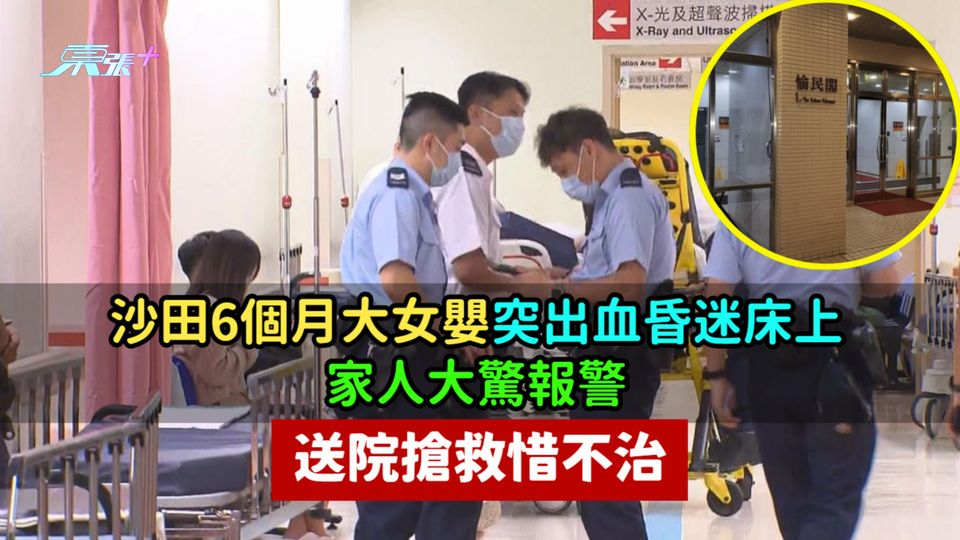 沙田6個月大女嬰突出血昏迷床上  家人大驚報警送院搶救惜不治