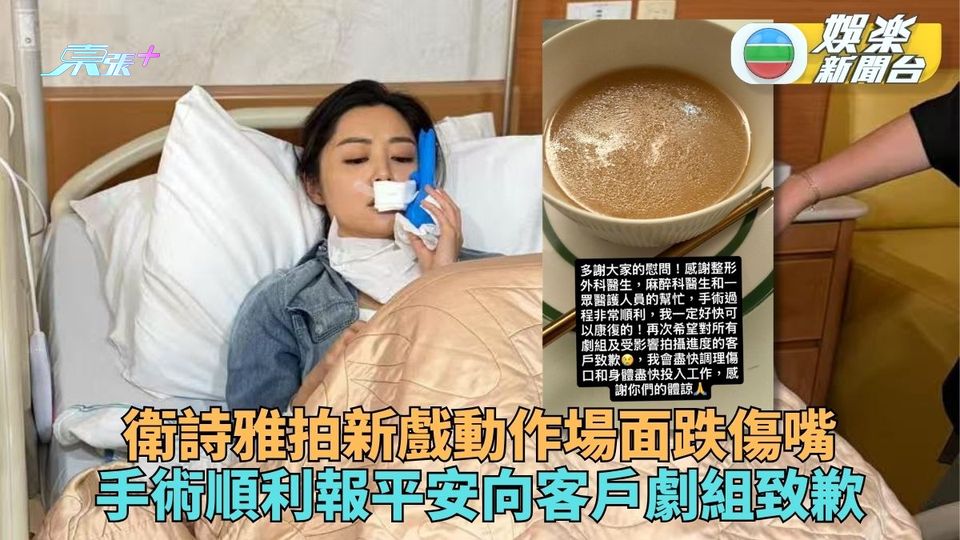 衛詩雅受傷手術後報平安 更新限時動態向客戶劇組致歉