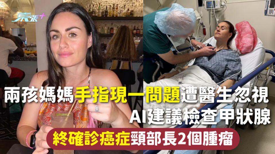 甲狀腺癌 | 兩孩媽媽手指現一問題遭醫生忽視 AI建議檢查甲狀腺 終確診癌症頸部長2個腫瘤
