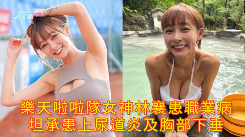 樂天啦啦隊女神林襄患職業病 坦承患上尿道炎及胸部下垂