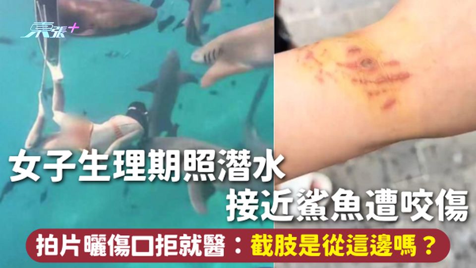 女子生理期照潛水 接近鯊魚遭咬傷 拍片曬傷口拒就醫：截肢是從這邊嗎？