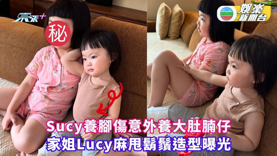 Sucy養腳傷意外養大肚腩仔 家姐Lucy麻甩鬍鬚造型曝光