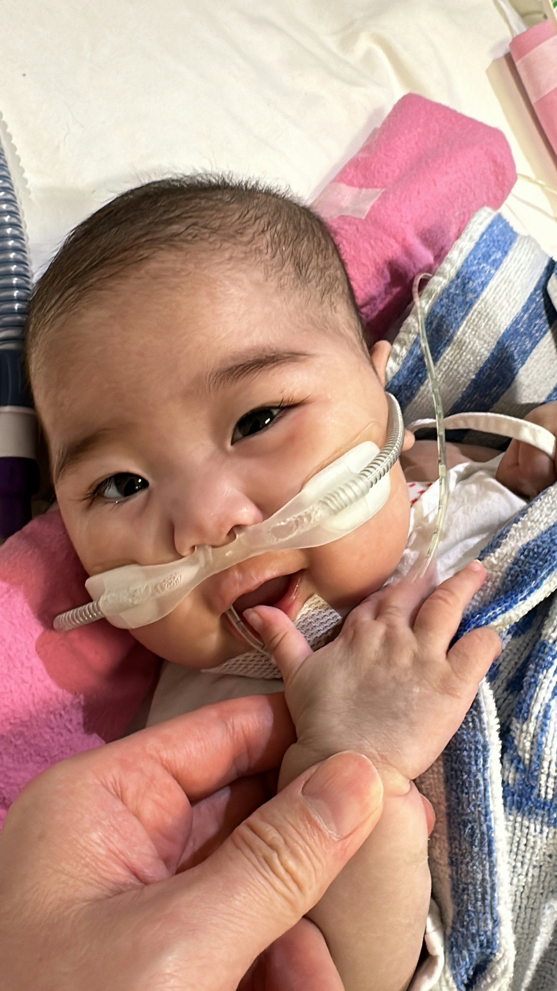 7個月大女嬰祈祈情況危殆急需換心。(醫管局提供)