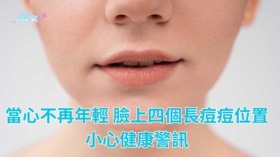 當心不再年輕 臉上四個長痘痘位置小心健康警訊