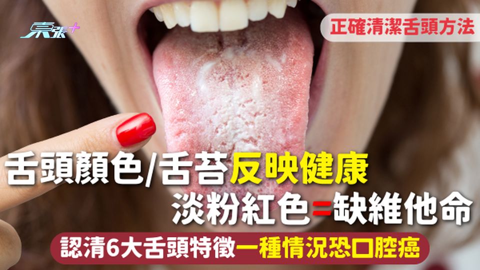 舌頭顏色/舌苔反映健康 淡粉紅色=缺維他命 認清6大舌頭特徵一種情況恐口腔癌 正確清潔舌頭方法