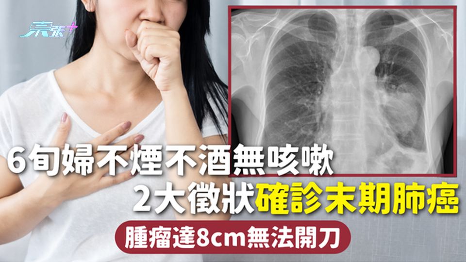 肺癌 | 6旬婦不煙不酒無咳嗽 2大徵狀確診末期肺癌 腫瘤達8cm無法開刀