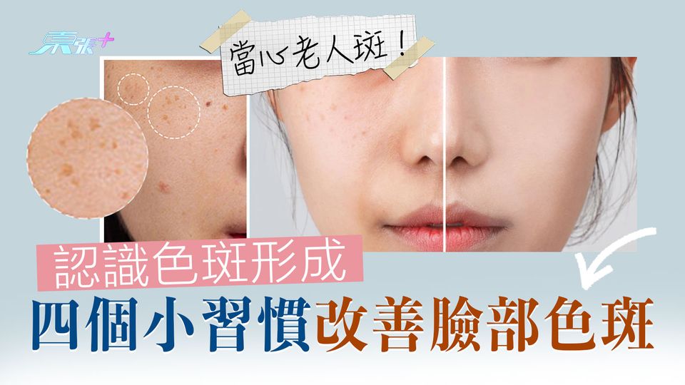 當心老人斑！認識色斑形成 四個小習慣改善臉部色斑