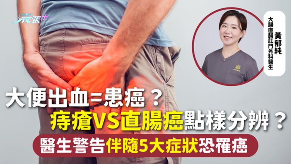 直腸癌 | 大便出血=患癌? 痔瘡VS直腸癌點樣分辨? 醫生警告伴隨5大症狀恐罹癌