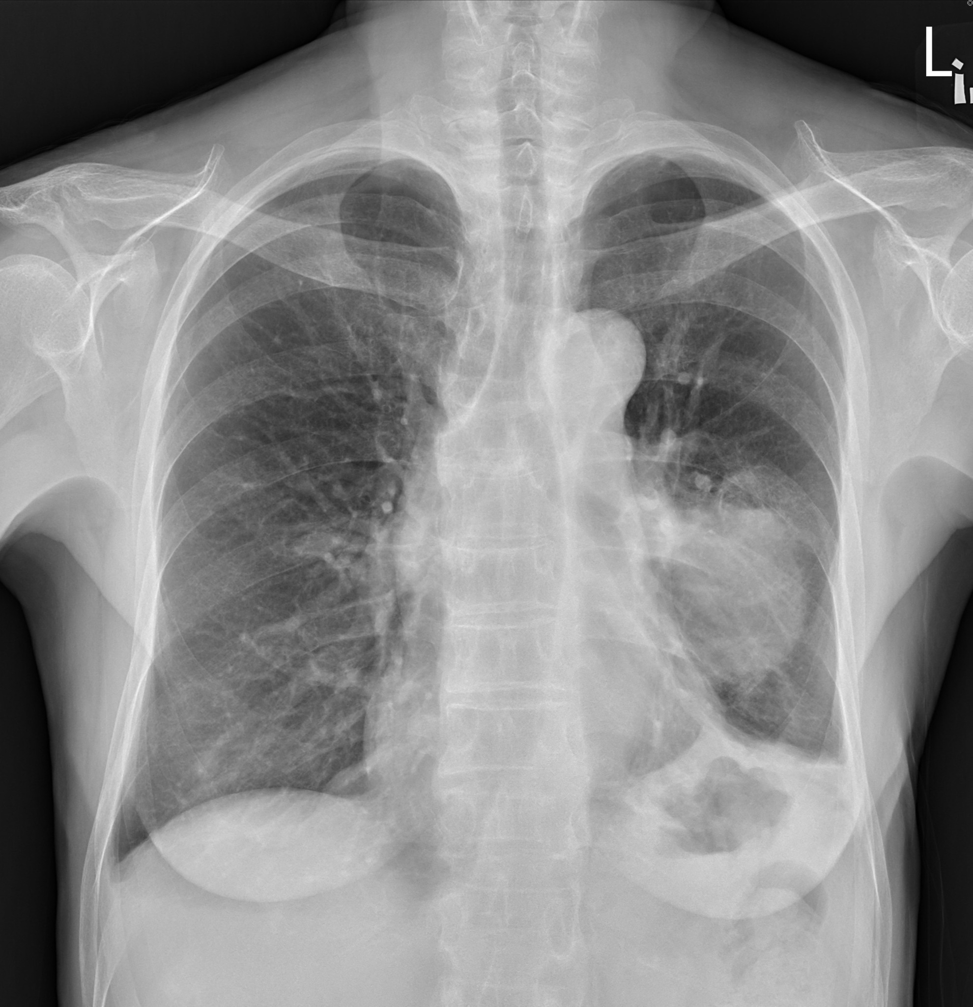 May be an image of xray