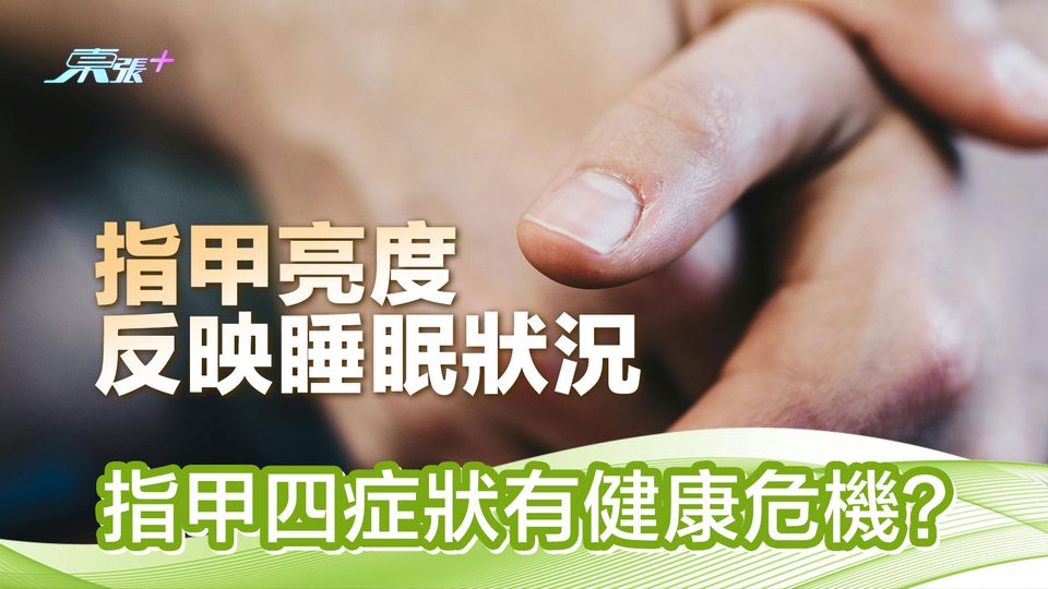 指甲亮度反映睡眠狀況 指甲四症狀有健康危機?
