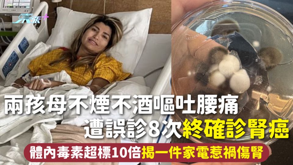 腎癌 | 兩孩母不煙不酒嘔吐腰痛 遭誤診8次終確診腎癌 體內毒素超標10倍揭一件家電惹禍傷腎