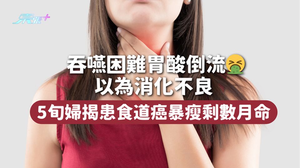 食道癌 | 吞嚥困難胃酸倒流🤮以為消化不良 5旬婦揭患食道癌暴瘦剩數月命