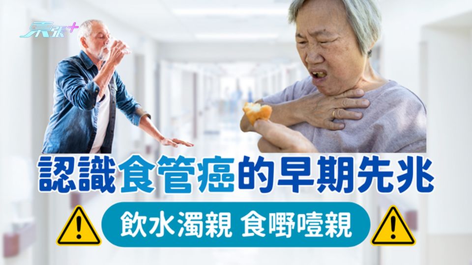 飲水成日濁親 原來係有依個癌!? ⚠️ 認識食管癌的早期先兆