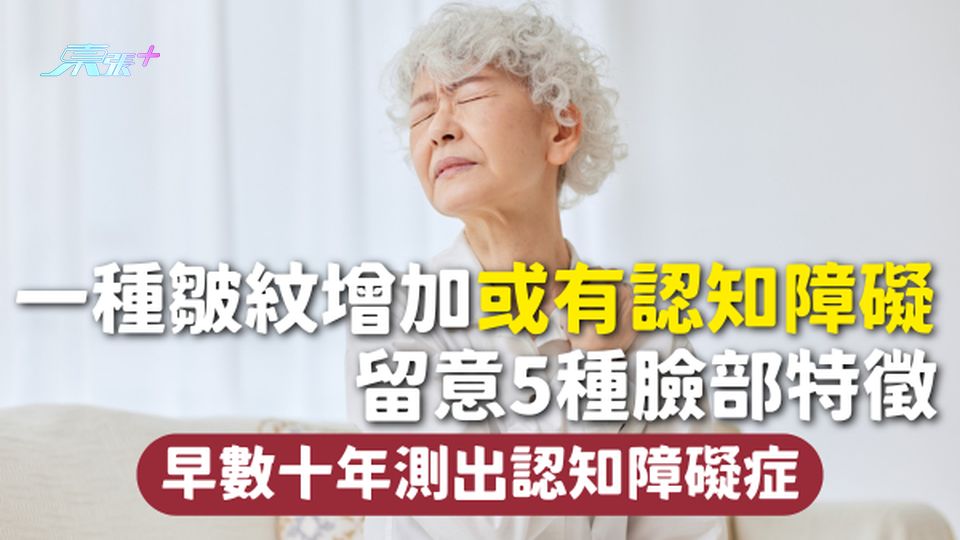 認知障礙症 | 一種皺紋增加或有認知障礙 留意5種臉部特徵 早數十年測出認知障礙症