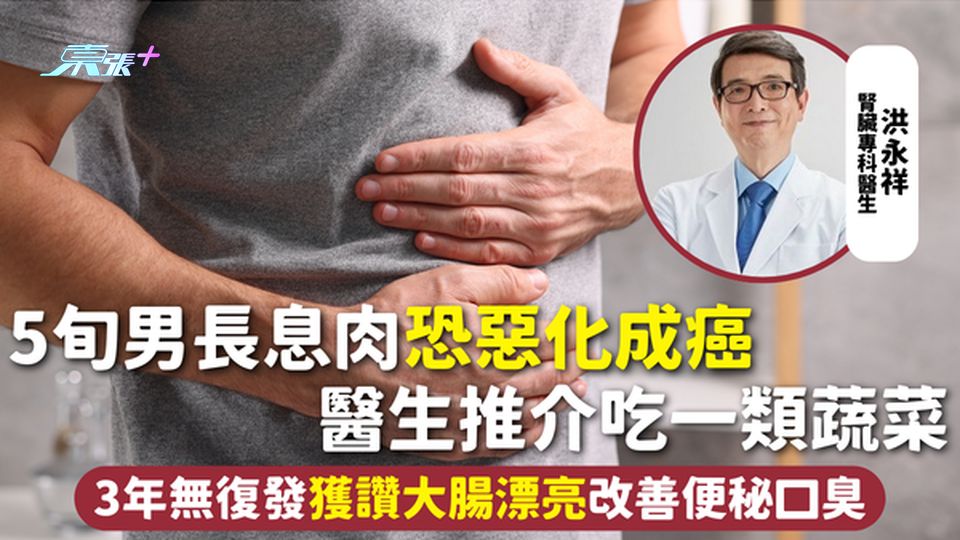 大腸癌 | 5旬男長息肉恐惡化成癌 醫生推介吃一類蔬菜 3年無復發獲讚大腸漂亮改善便秘口臭