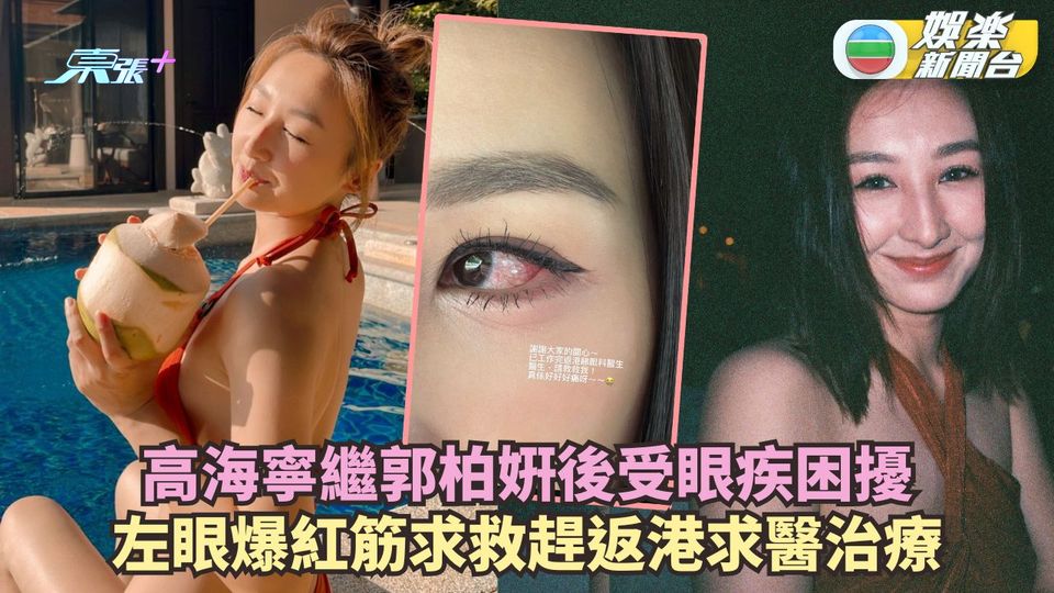 高海寧眼疾困擾腫痛唔斷尾 左眼爆紅筋趕返港求醫治療