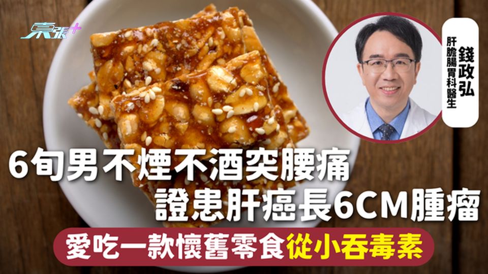 肝癌 | 6旬男不煙不酒突腰痛 證患肝癌長6cm腫瘤 愛吃一款懷舊零食從小吞毒素