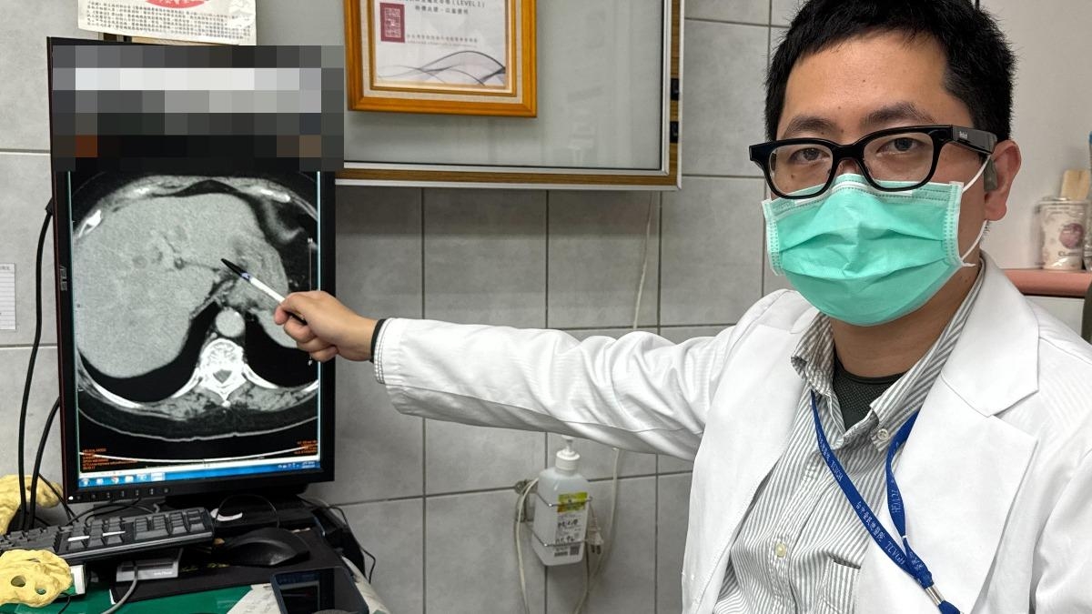 吳坤達強調，近年來飲食西化，代謝異常脂肪肝是肝癌的高風險因子。（圖／大甲李綜合醫院提供）