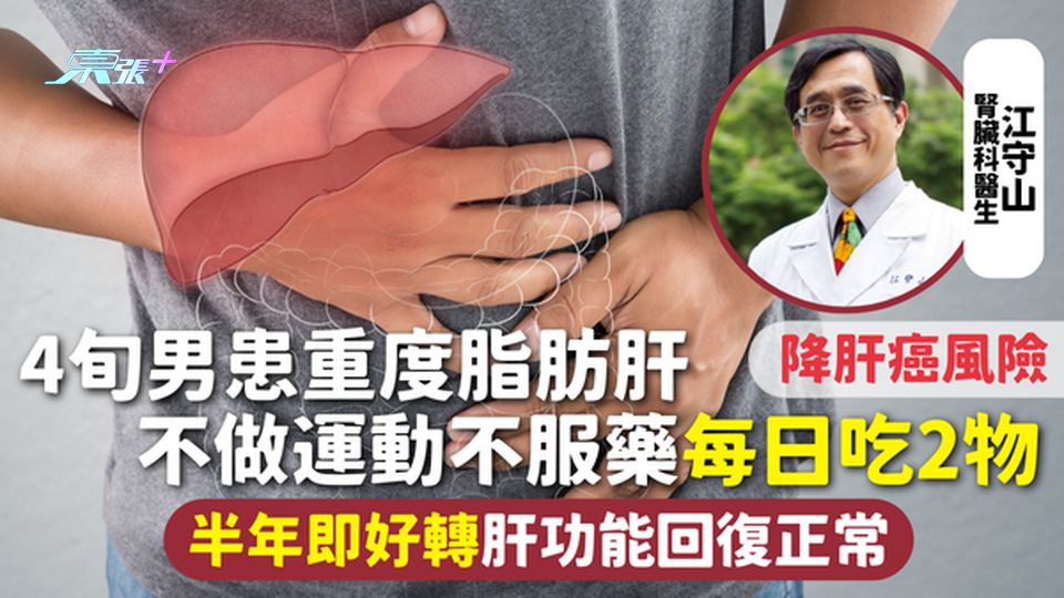 脂肪肝 | 4旬男患重度脂肪肝 不做運動不服藥每日吃2物 半年即好轉肝功能回復正常 降肝癌風險