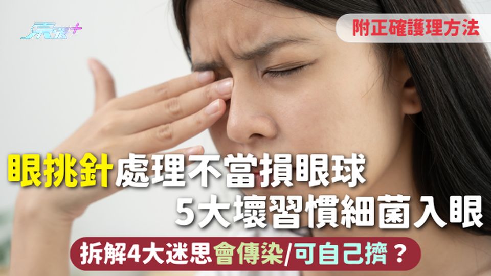 眼挑針 | 針眼處理不當損眼球 5大壞習慣細菌入眼 拆解4大迷思會傳染/可自己擠？附正確護理方法