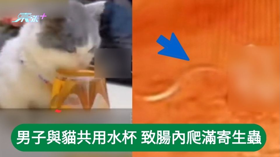 男子與貓共用水杯 致腸內爬滿寄生蟲