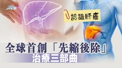 認識肝癌 全球首創「先縮後除」治療三部曲