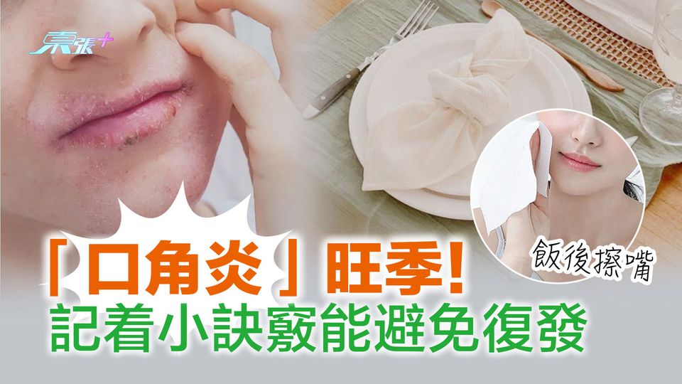 「口角炎」旺季！記着小訣竅能避免復發