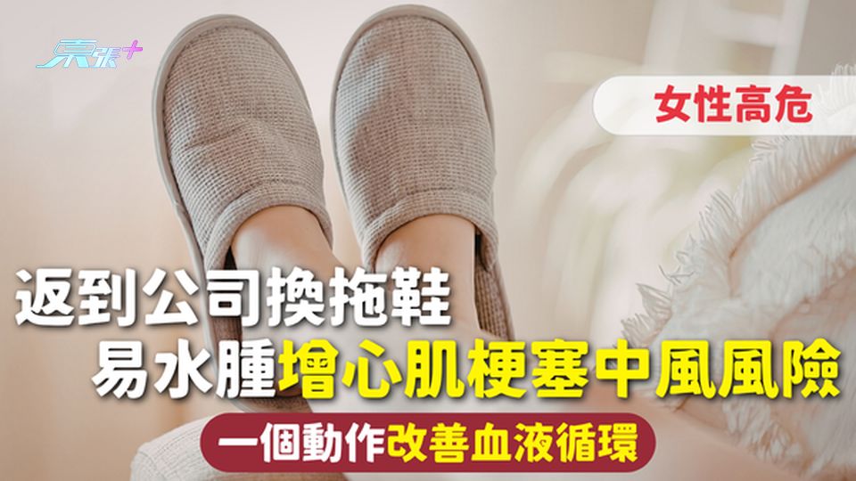 辦公室健康 | 返到公司換拖鞋 易水腫增心肌梗塞中風風險女性高危 一個動作改善血液循環